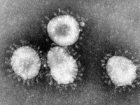 Coronaviruses are a group of viruses that have a halo, or crown-like (corona) appearance when viewed under an electron microscope.